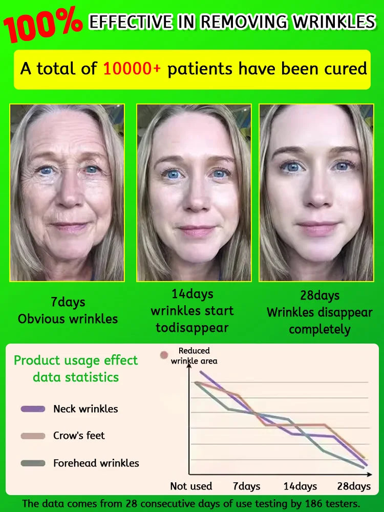 Retinol serum for reducing fine lines, moisturizing, wrinkle removal, facial skin care, Korean skin care 30g, facial care