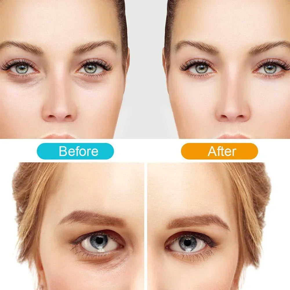 Eye Massager Relieves Eye Fatigue Eyes Massage Glasses Eye Fatigue Relief Massager