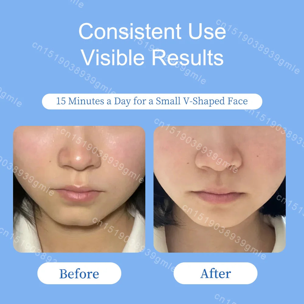 EMS Micro-Current Face Massage Roller Neck Face Lifting Firming Facial Lift Massager Anti Wrinkle Face Slimming Beauty Skin Care