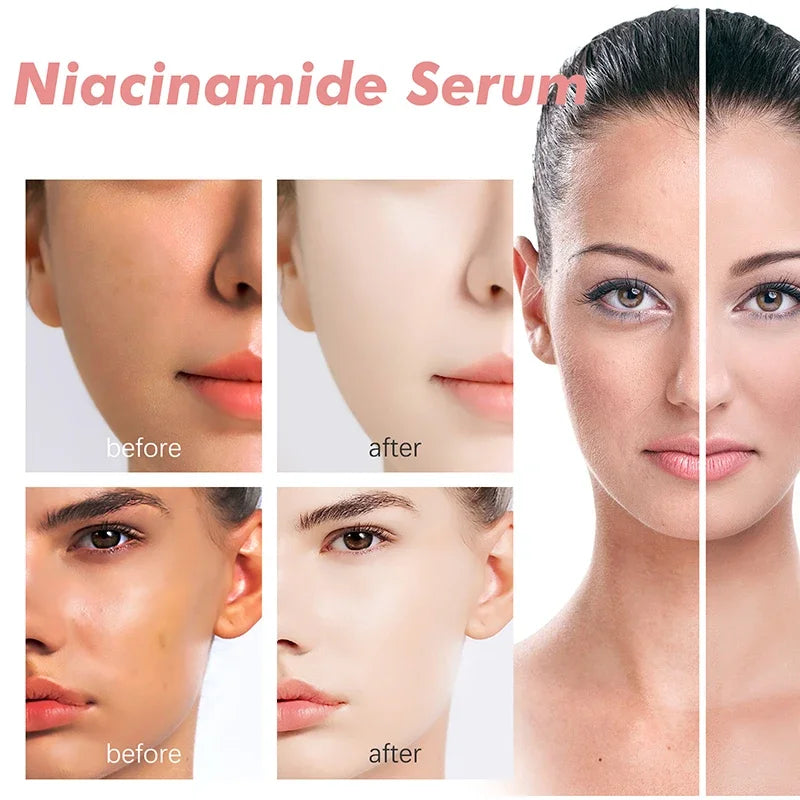 30ml Peach 70% Niacinamide Serum Moisturizing Prevent Dryness Facial Essential Oil Increasing Elasticity Smooth Soften Skin Care